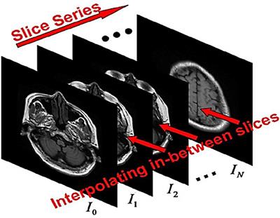 Medical Image Interpolation Using Recurrent Type-2 Fuzzy Neural Network